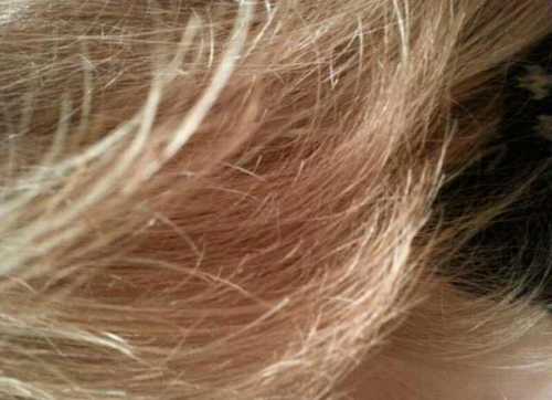 Секущиеся кончики волос: описание, причины, лечение